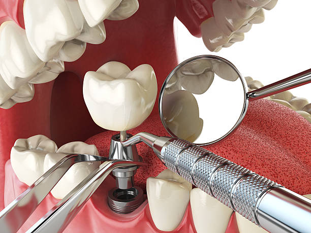 Best Emergency Dental Care for Trauma or Injury in Smyrna, GA
